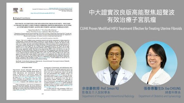 Cuhk Proves Modified Hifu Treatment Effective For Treating Uterine Fibroids 